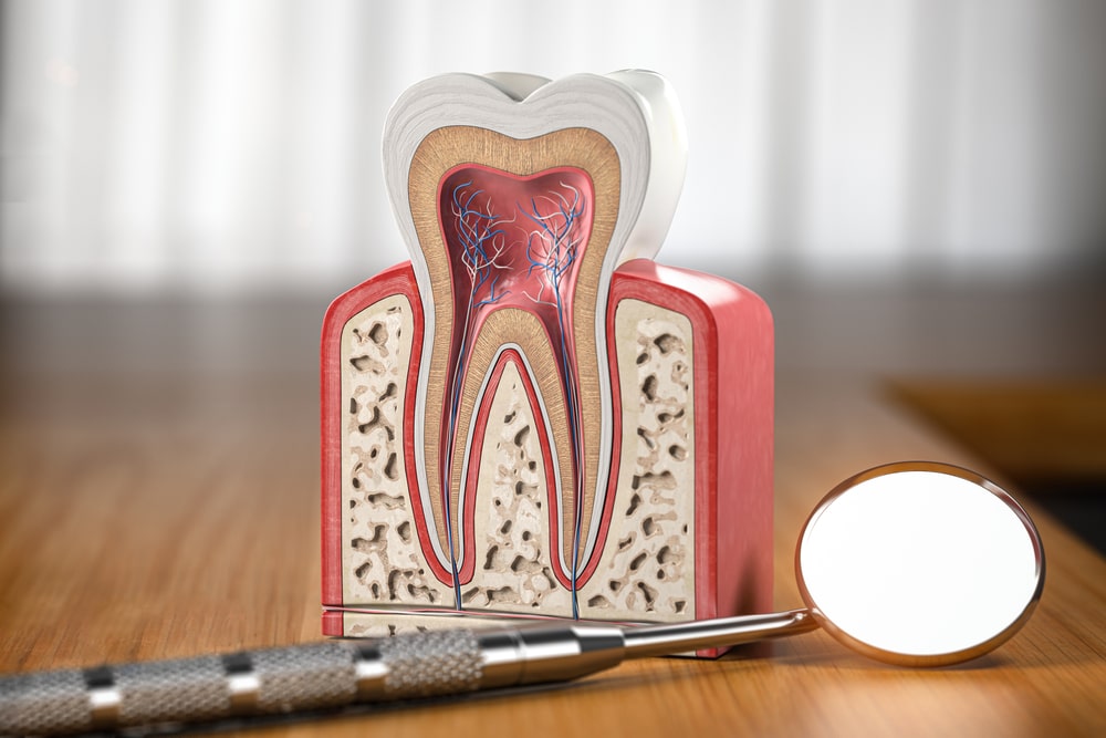 La parodontite affecte les tissus qui entourent les racines dentaires